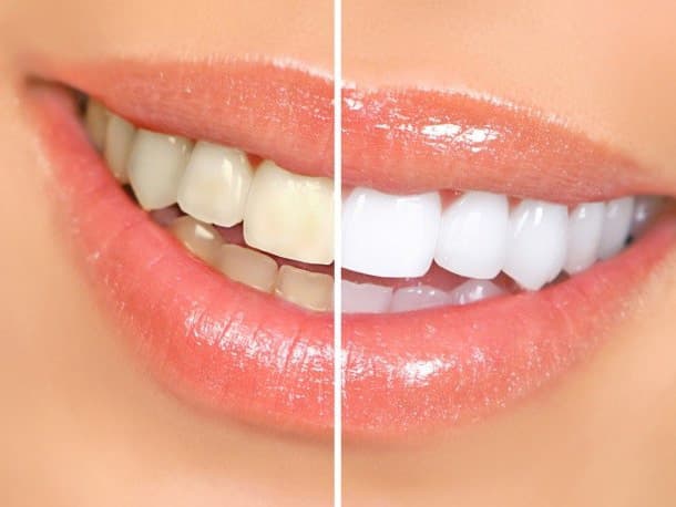 Healthy smile
