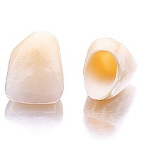 service dental crowns and dental bridges